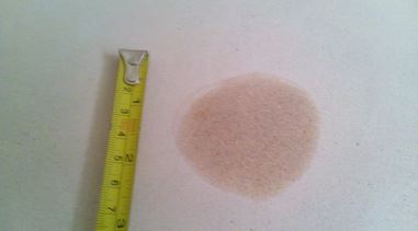 Stop Damp Patches On Internal Walls The Damp Buster